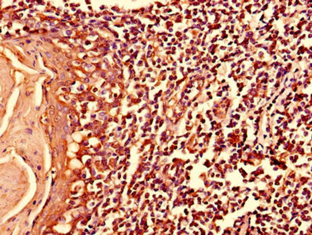 Immunohistochemistry of paraffin-embedded human tonsil tissue using CSB-PA884628LA01HU at dilution of 1:100