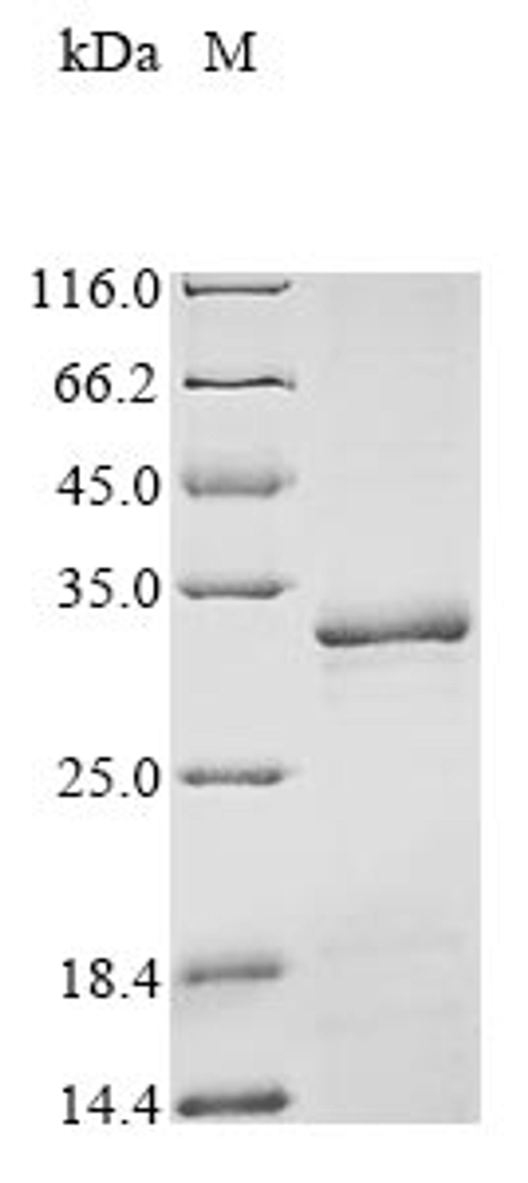(Tris-Glycine gel) Discontinuous SDS-PAGE (reduced) with 5% enrichment gel and 15% separation gel.