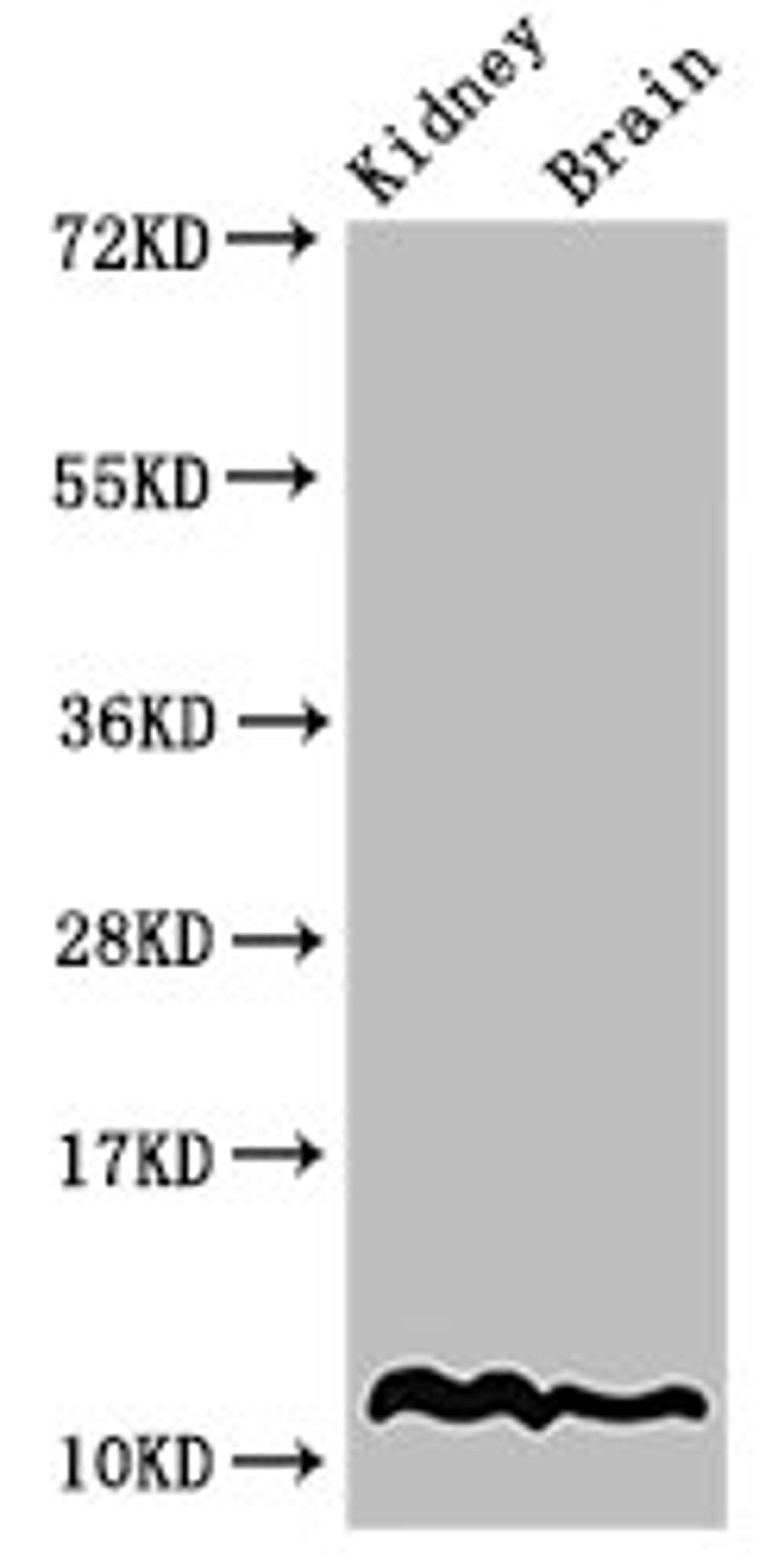 Western Blot. Positive WB detected in: Mouse kidney tissue, Mouse brain tissue. All lanes: HIST1H4A antibody at 2µg/ml. Secondary. Goat polyclonal to rabbit IgG at 1/50000 dilution. Predicted band size: 12 kDa. Observed band size: 12 kDa
