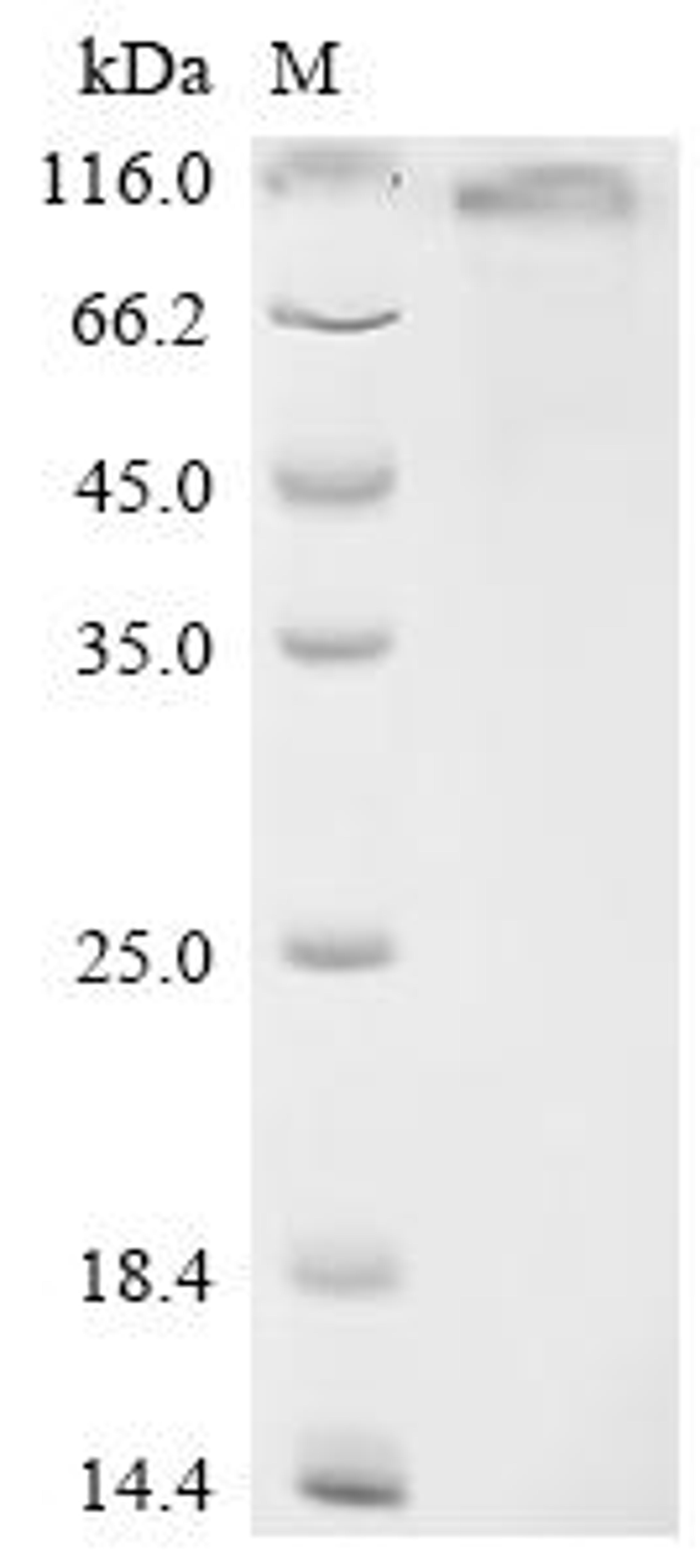 (Tris-Glycine gel) Discontinuous SDS-PAGE (reduced) with 5% enrichment gel and 15% separation gel.