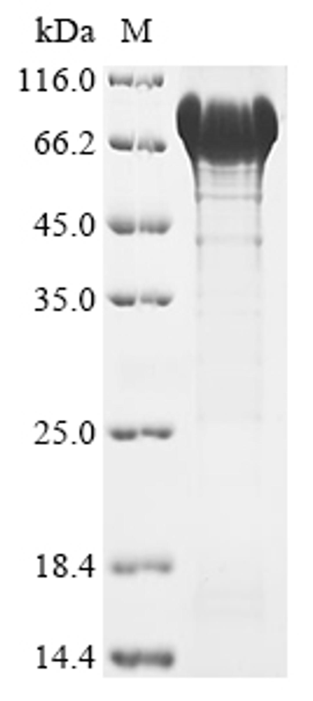 (Tris-Glycine gel) Discontinuous SDS-PAGE (reduced) with 5% enrichment gel and 15% separation gel.