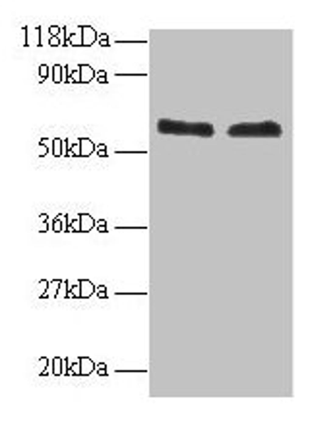 Western blot. All lanes: FUS antibody at 2µg/ml. Lane 1: 293T whole cell lysate. Lane 2: EC109 whole cell lysate. Secondary. Goat polyclonal to rabbit IgG at 1/15000 dilution. Predicted band size: 54 kDa. Observed band size: 60 kDa