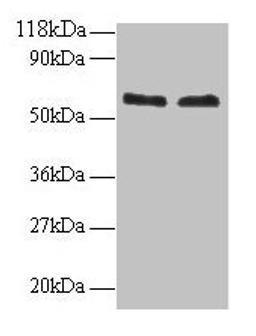 Western blot. All lanes: FUS antibody at 2µg/ml. Lane 1: 293T whole cell lysate. Lane 2: EC109 whole cell lysate. Secondary. Goat polyclonal to rabbit IgG at 1/15000 dilution. Predicted band size: 54 kDa. Observed band size: 60 kDa