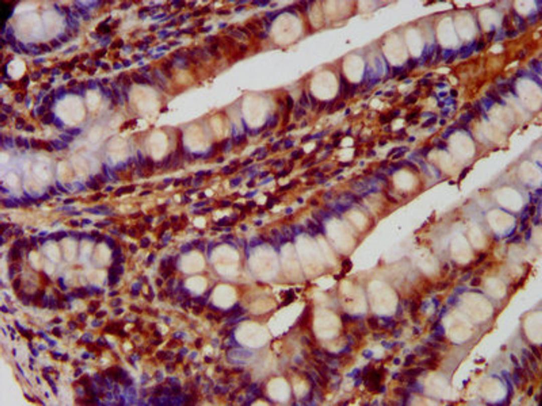 IHC image of CSB-PA007087LA01HU diluted at 1:600 and staining in paraffin-embedded human small intestine tissue performed on a Leica BondTM system. After dewaxing and hydration, antigen retrieval was mediated by high pressure in a citrate buffer (pH 6.0). Section was blocked with 10% normal goat serum 30min at RT. Then primary antibody (1% BSA) was incubated at 4&deg;C overnight. The primary is detected by a biotinylated secondary antibody and visualized using an HRP conjugated SP system.