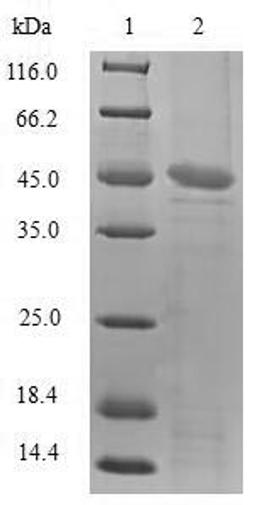 (Tris-Glycine gel) Discontinuous SDS-PAGE (reduced) with 5% enrichment gel and 15% separation gel.