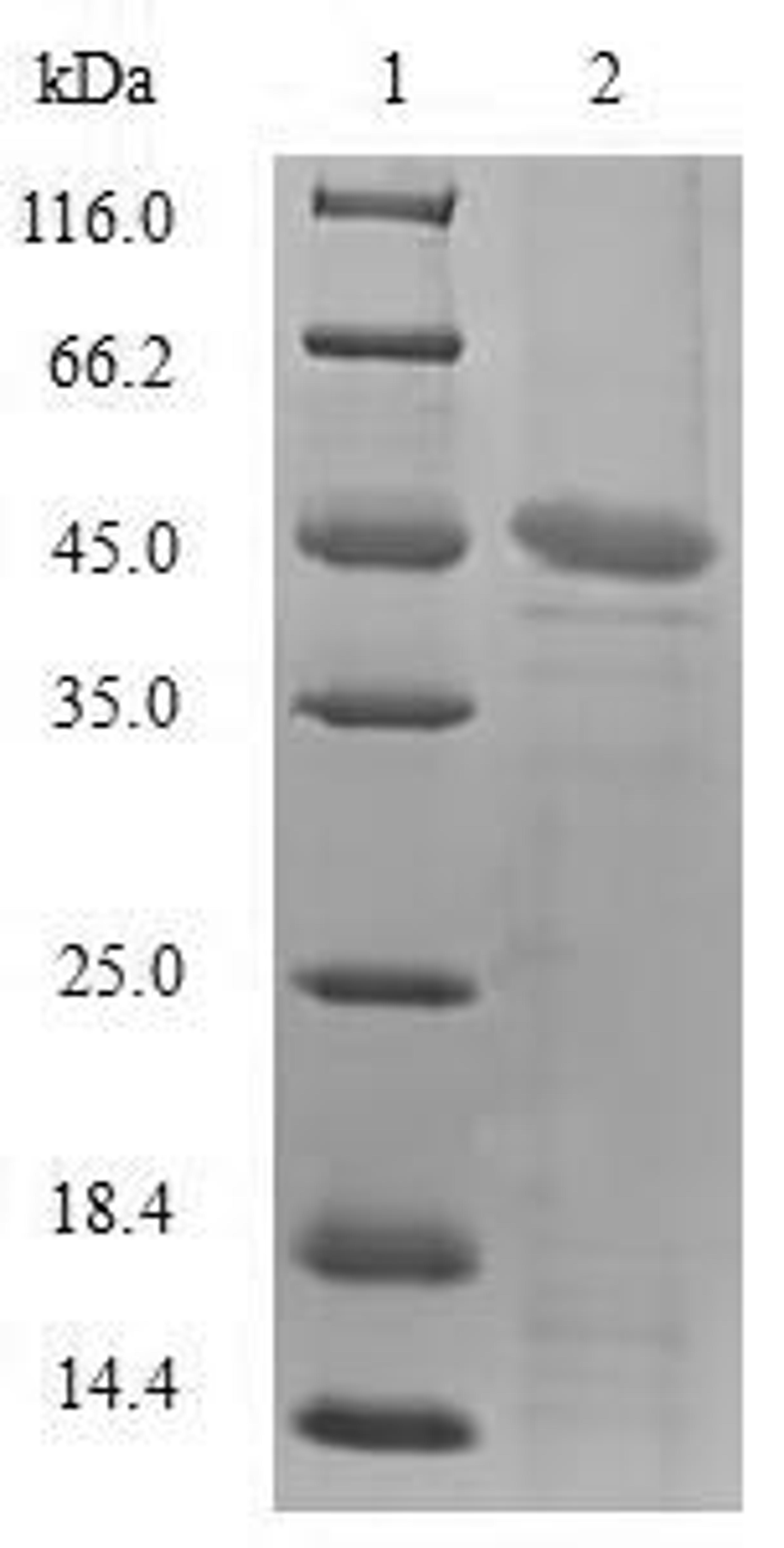 (Tris-Glycine gel) Discontinuous SDS-PAGE (reduced) with 5% enrichment gel and 15% separation gel.