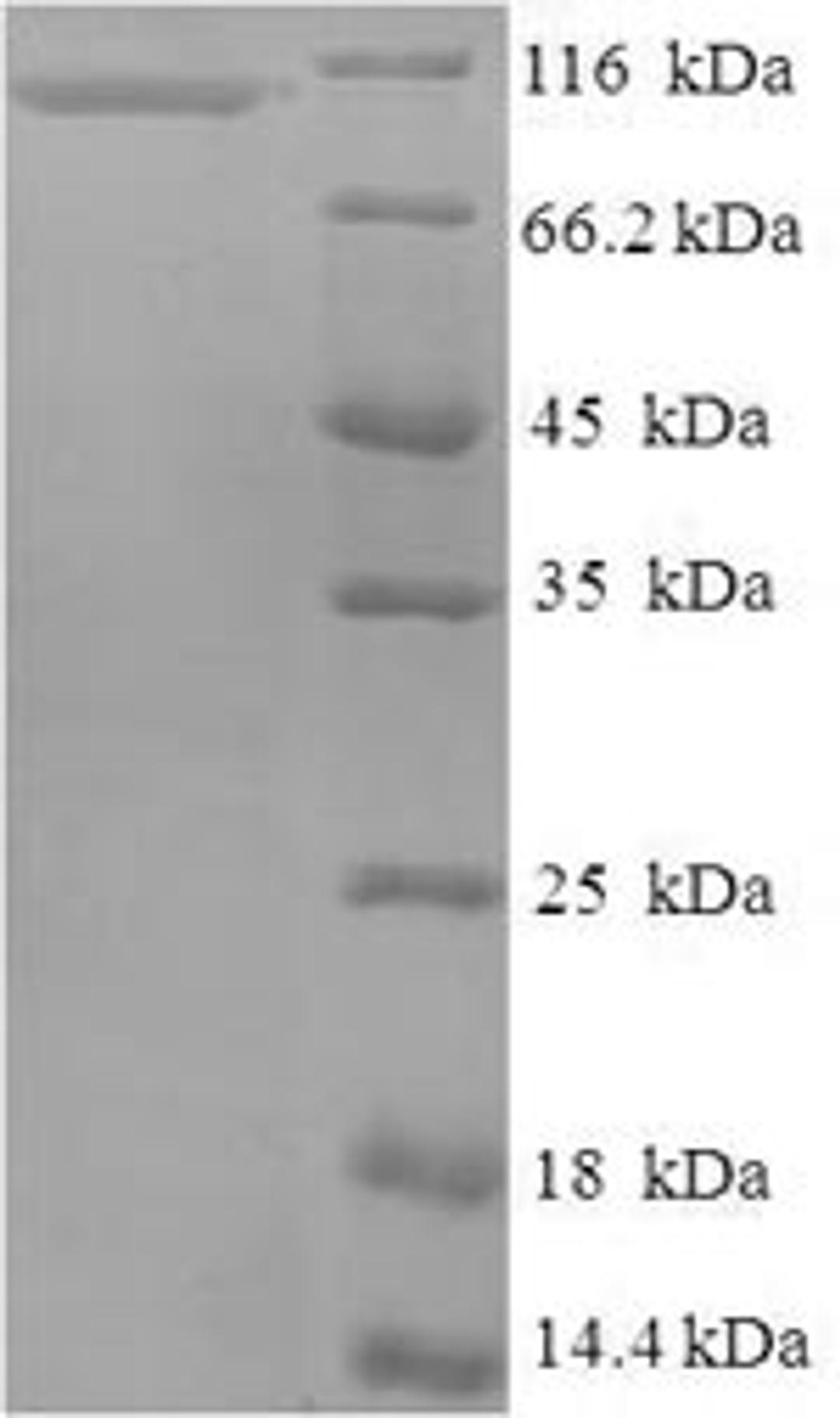 (Tris-Glycine gel) Discontinuous SDS-PAGE (reduced) with 5% enrichment gel and 15% separation gel.