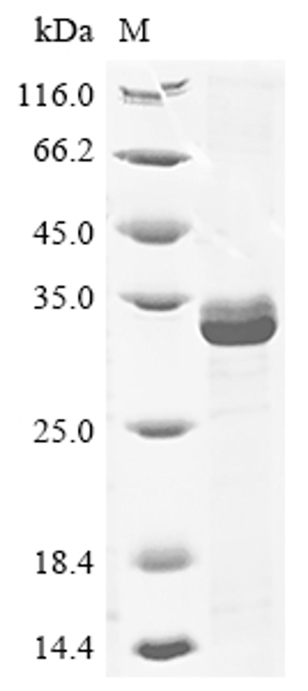 (Tris-Glycine gel) Discontinuous SDS-PAGE (reduced) with 5% enrichment gel and 15% separation gel.