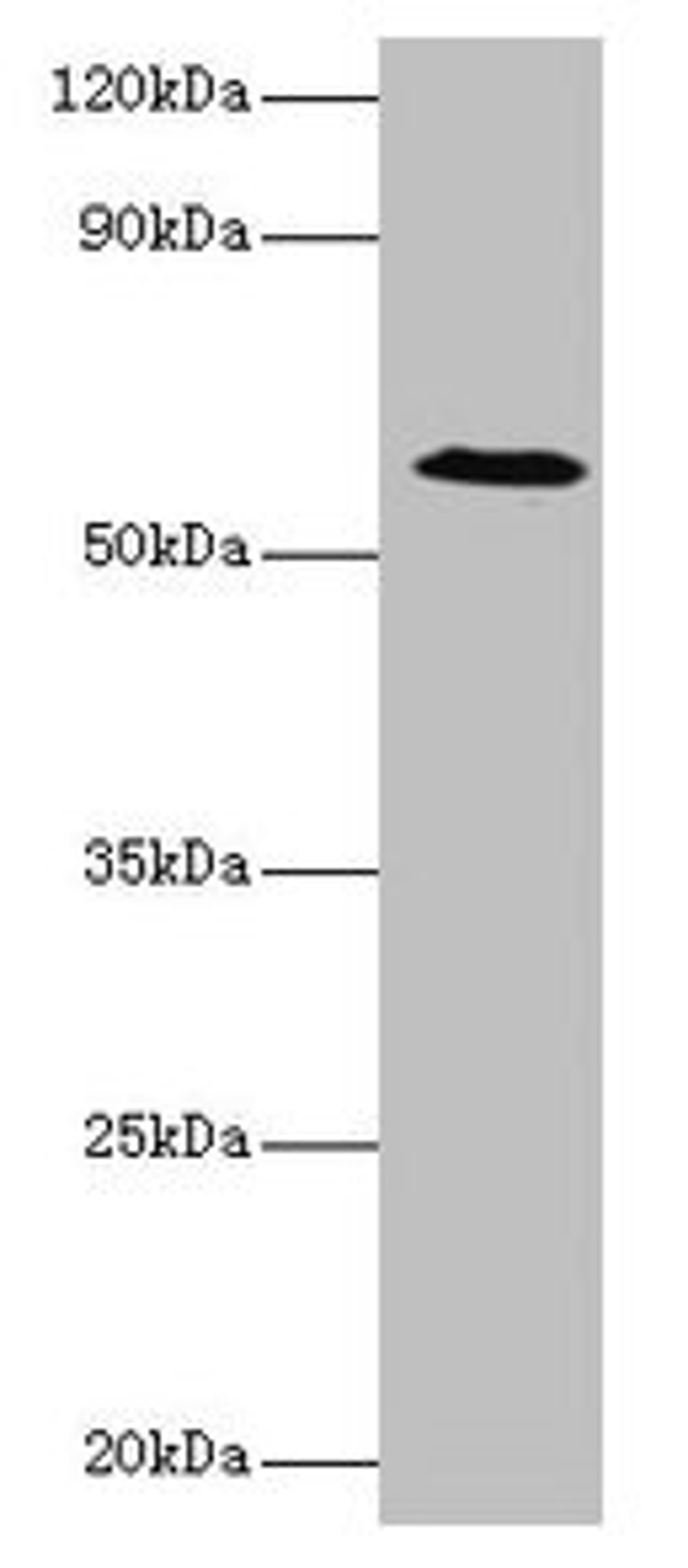 Western blot. All lanes: UGP2 antibody at 2µg/ml + Mouse liver tissue. Secondary. Goat polyclonal to rabbit IgG at 1/10000 dilution. Predicted band size: 57, 56 kDa. Observed band size: 57 kDa