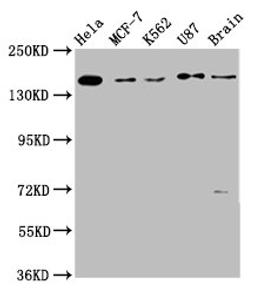 Western Blot. Positive WB detected in: Hela whole cell lysate, MCF-7 whole cell lysate, K562 whole cell lysate, U87 whole cell lysate, Rat brain tissue. All lanes: RAD54L2 antibody at 3.7µg/ml. Secondary. Goat polyclonal to rabbit IgG at 1/50000 dilution. Predicted band size: 163 kDa. Observed band size: 163 kDa