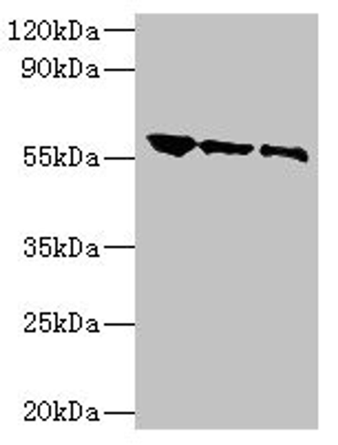 Western blot. All lanes: Rabies virus Glycoprotein G antibody at 1: 500. Lane 1: Rabies virus antigen 1: 2. Lane 2: Rabies virus antigen 1: 10. Lane 3: Rabies virus antigen 1: 20. Secondary. Goat polyclonal to rabbit IgG at 1/10000 dilution. Predicted band size: 55 kDa. Observed band size: 55 kDa