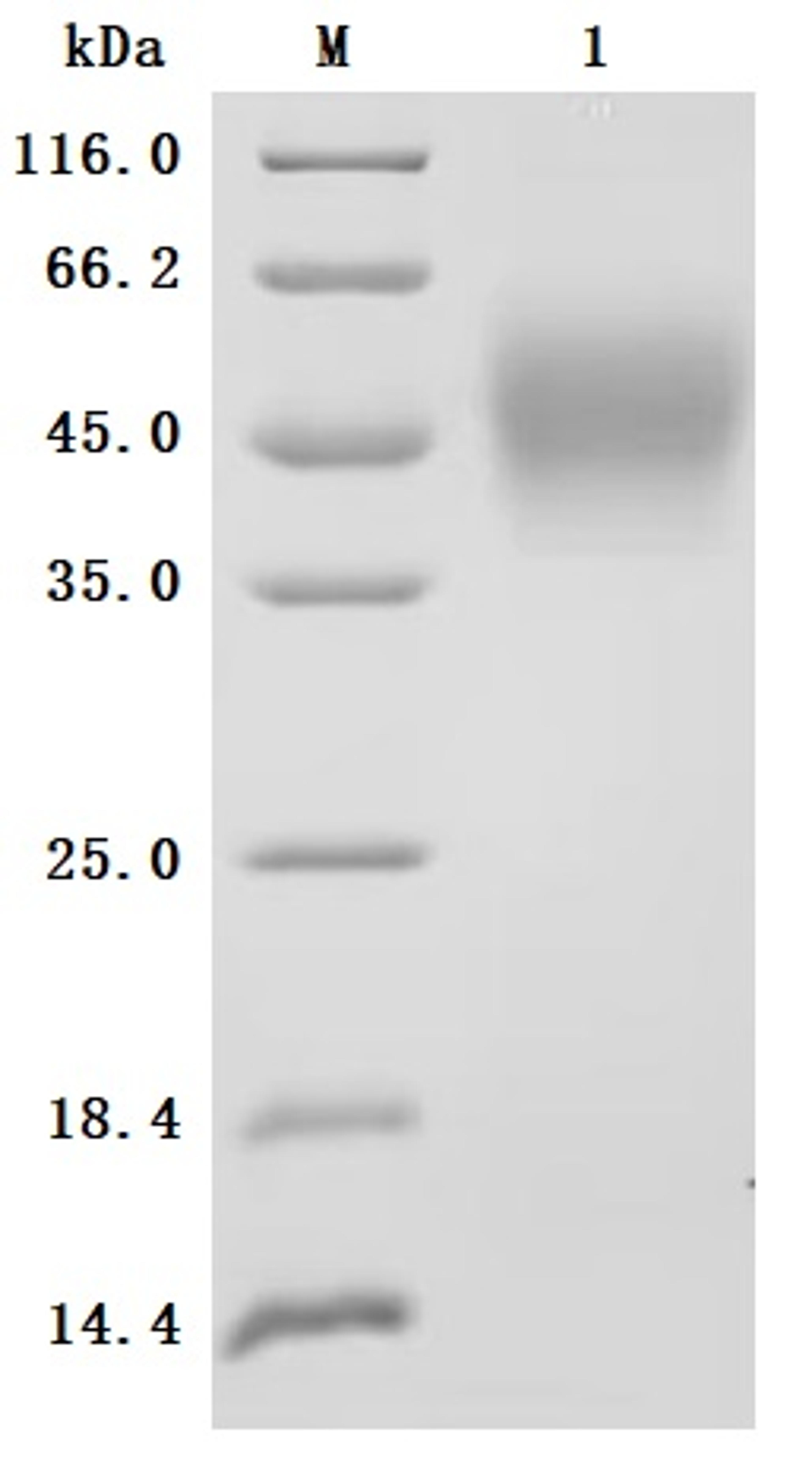 (Tris-Glycine gel) Discontinuous SDS-PAGE (reduced) with 5% enrichment gel and 15% separation gel.