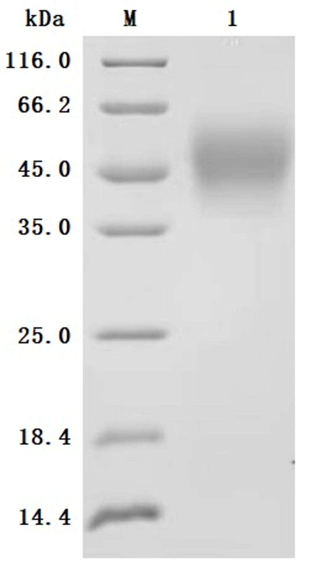 (Tris-Glycine gel) Discontinuous SDS-PAGE (reduced) with 5% enrichment gel and 15% separation gel.