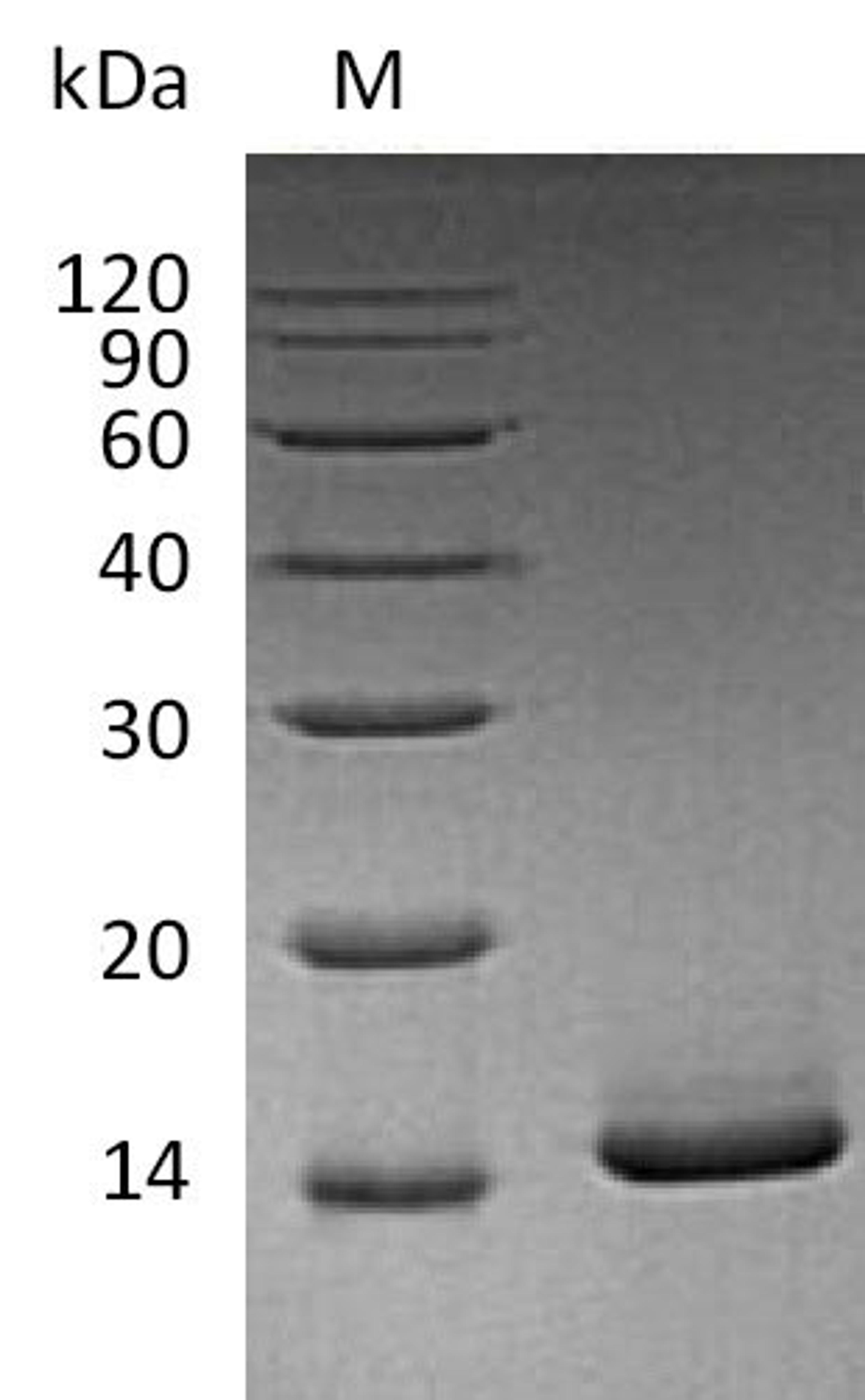 (Tris-Glycine gel) Discontinuous SDS-PAGE (reduced) with 5% enrichment gel and 15% separation gel.
