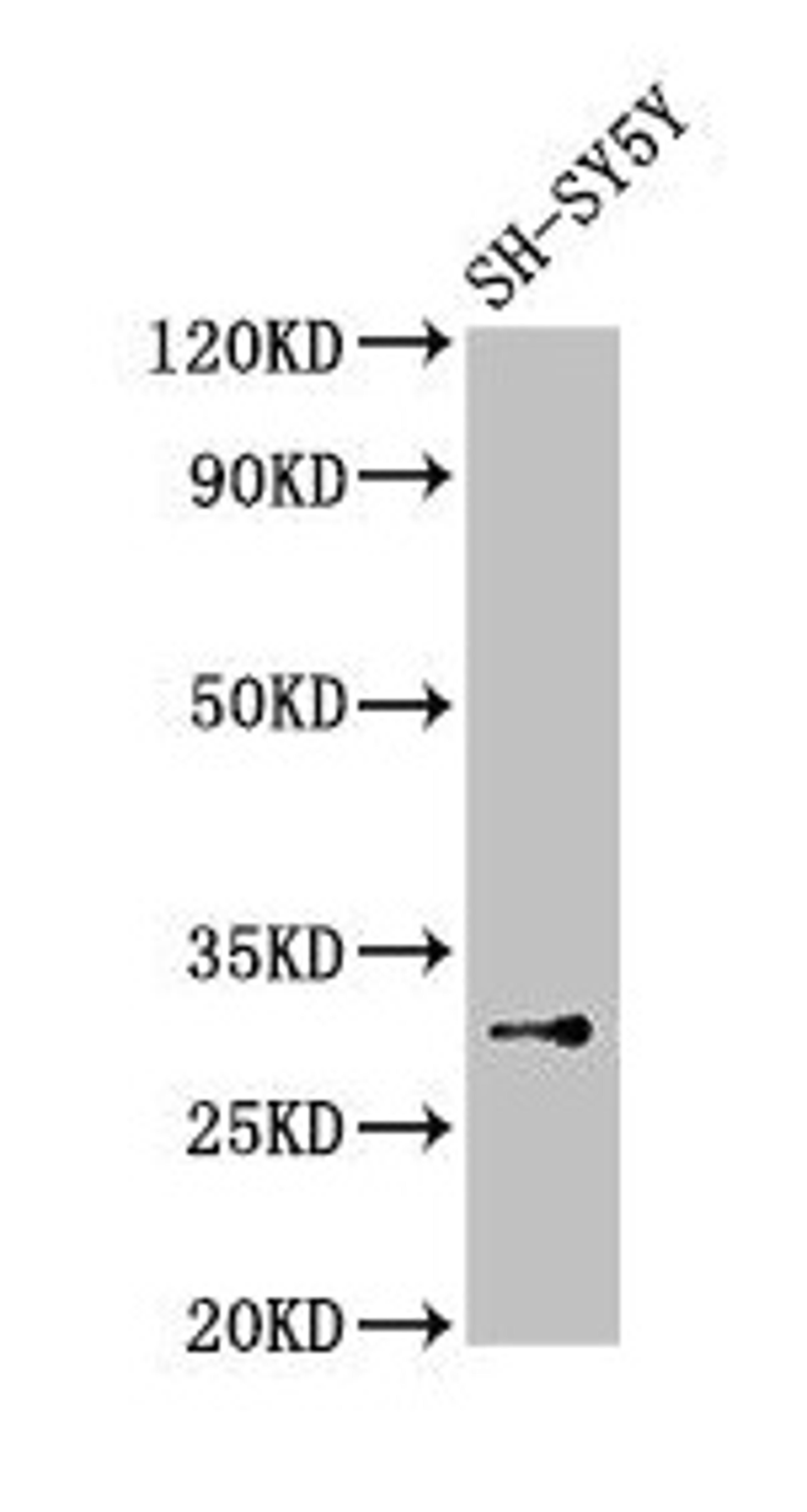 Western Blot. Positive WB detected in: SH-SY5Y whole cell lysate. All lanes: ISOC1 antibody at 3.5µg/ml. Secondary. Goat polyclonal to rabbit IgG at 1/50000 dilution. Predicted band size: 33 kDa. Observed band size: 33 kDa
