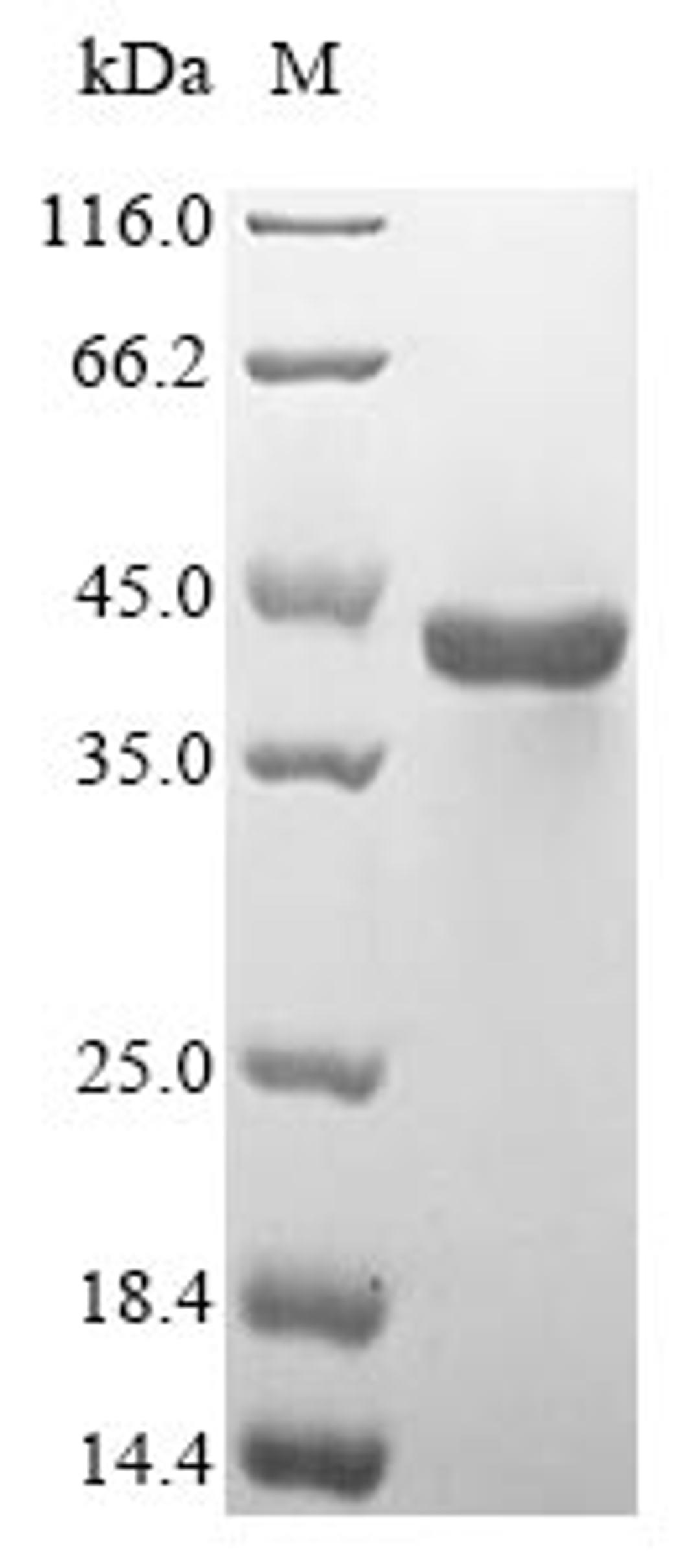 (Tris-Glycine gel) Discontinuous SDS-PAGE (reduced) with 5% enrichment gel and 15% separation gel.