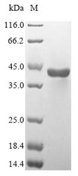(Tris-Glycine gel) Discontinuous SDS-PAGE (reduced) with 5% enrichment gel and 15% separation gel.