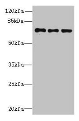 Western blot. All lanes: ZNF614 antibody at 6µg/ml. Lane 1: Jurkat whole cell lysate. Lane 2: HepG2 whole cell lysate. Lane 3: A549 whole cell lysate. Secondary. Goat polyclonal to rabbit IgG at 1/10000 dilution. Predicted band size: 68, 23 kDa. Observed band size: 68 kDa