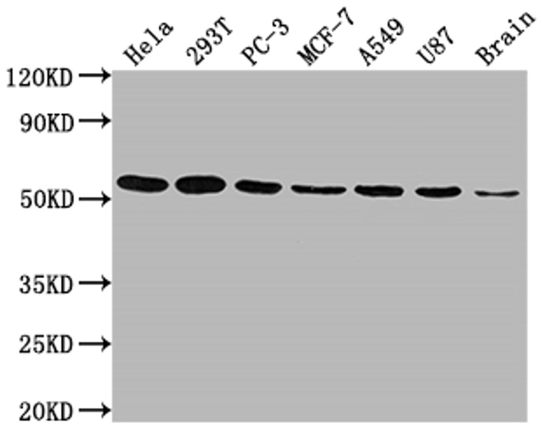 Western Blot. Positive WB detected in: Hela whole cell lysate, 293T whole cell lysate, PC-3 whole cell lysate, MCF-7 whole cell lysate, A549 whole cell lysate, U87 whole cell lysate, Brain tissue. All lanes: KLF4 antibody at 1:1500. Secondary. Goat polyclonal to rabbit IgG at 1/50000 dilution. Predicted band size: 55, 52, 46, 13, 7 kDa. Observed band size: 55 kDa. 