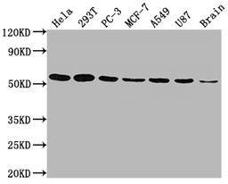 Western Blot. Positive WB detected in: Hela whole cell lysate, 293T whole cell lysate, PC-3 whole cell lysate, MCF-7 whole cell lysate, A549 whole cell lysate, U87 whole cell lysate, Brain tissue. All lanes: KLF4 antibody at 1:1500. Secondary. Goat polyclonal to rabbit IgG at 1/50000 dilution. Predicted band size: 55, 52, 46, 13, 7 kDa. Observed band size: 55 kDa. 