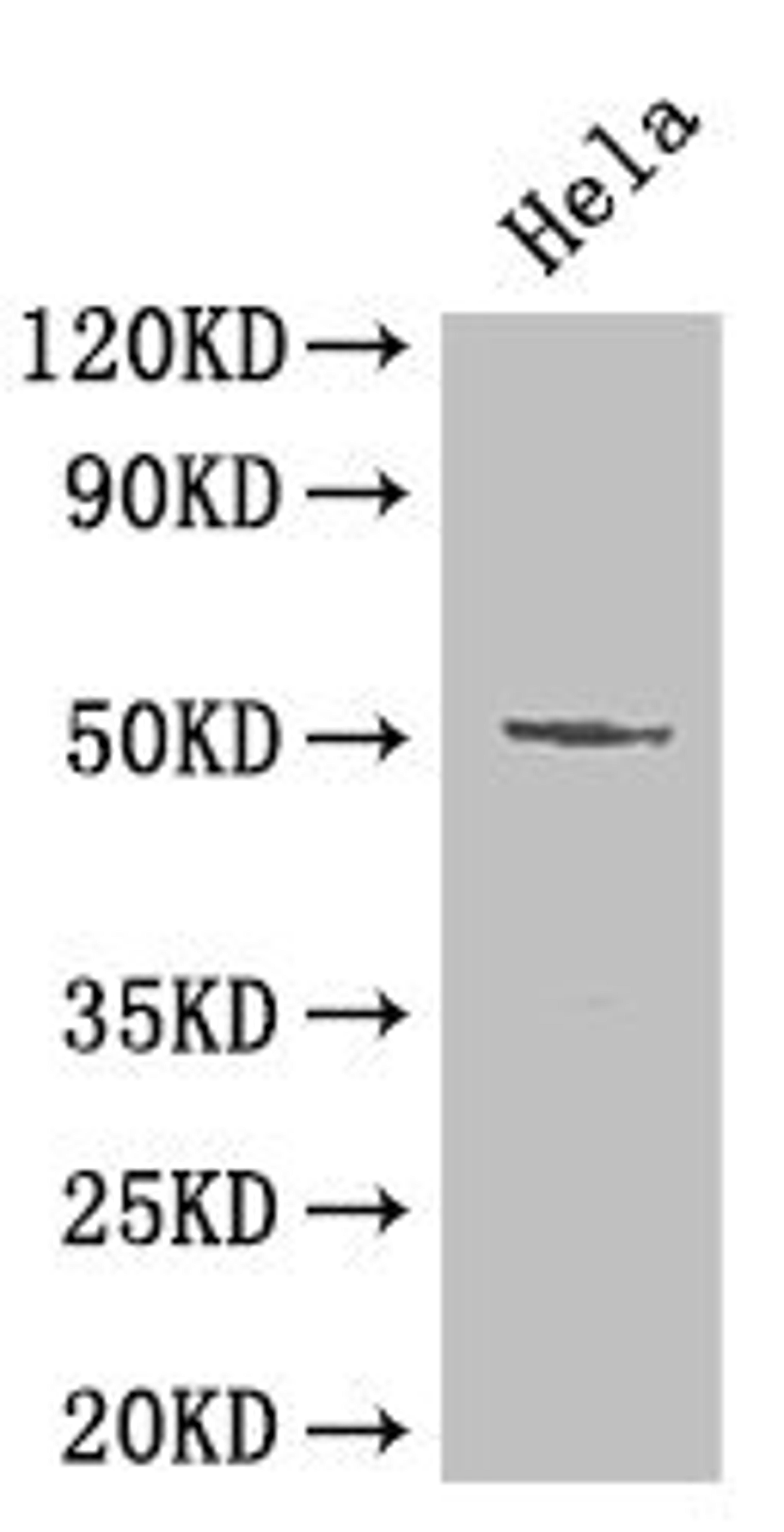 Western Blot. Positive WB detected in: Hela whole cell lysate. All lanes: POU2F2 antibody at 2µg/ml. Secondary. Goat polyclonal to rabbit IgG at 1/50000 dilution. Predicted band size: 52, 50, 44, 63 kDa. Observed band size: 52 kDa