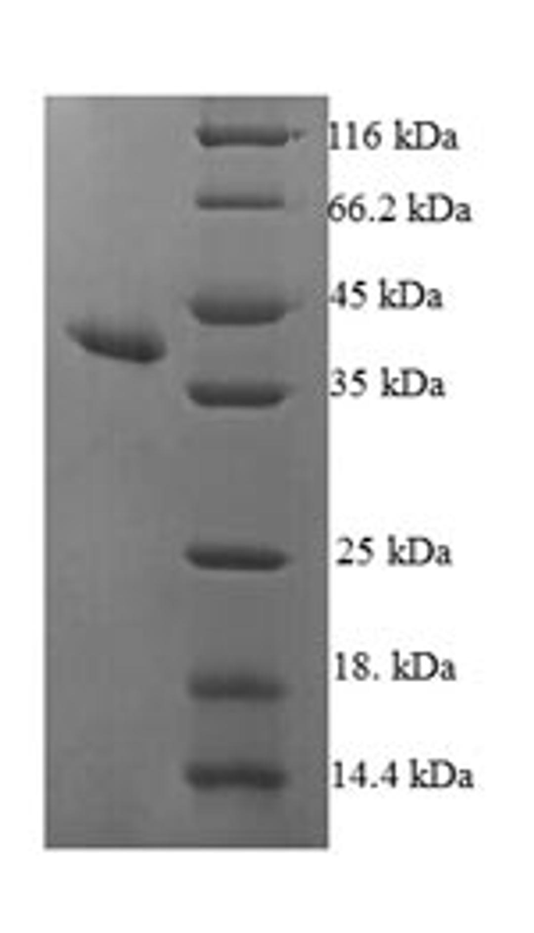 (Tris-Glycine gel) Discontinuous SDS-PAGE (reduced) with 5% enrichment gel and 15% separation gel.