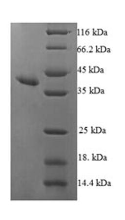 (Tris-Glycine gel) Discontinuous SDS-PAGE (reduced) with 5% enrichment gel and 15% separation gel.