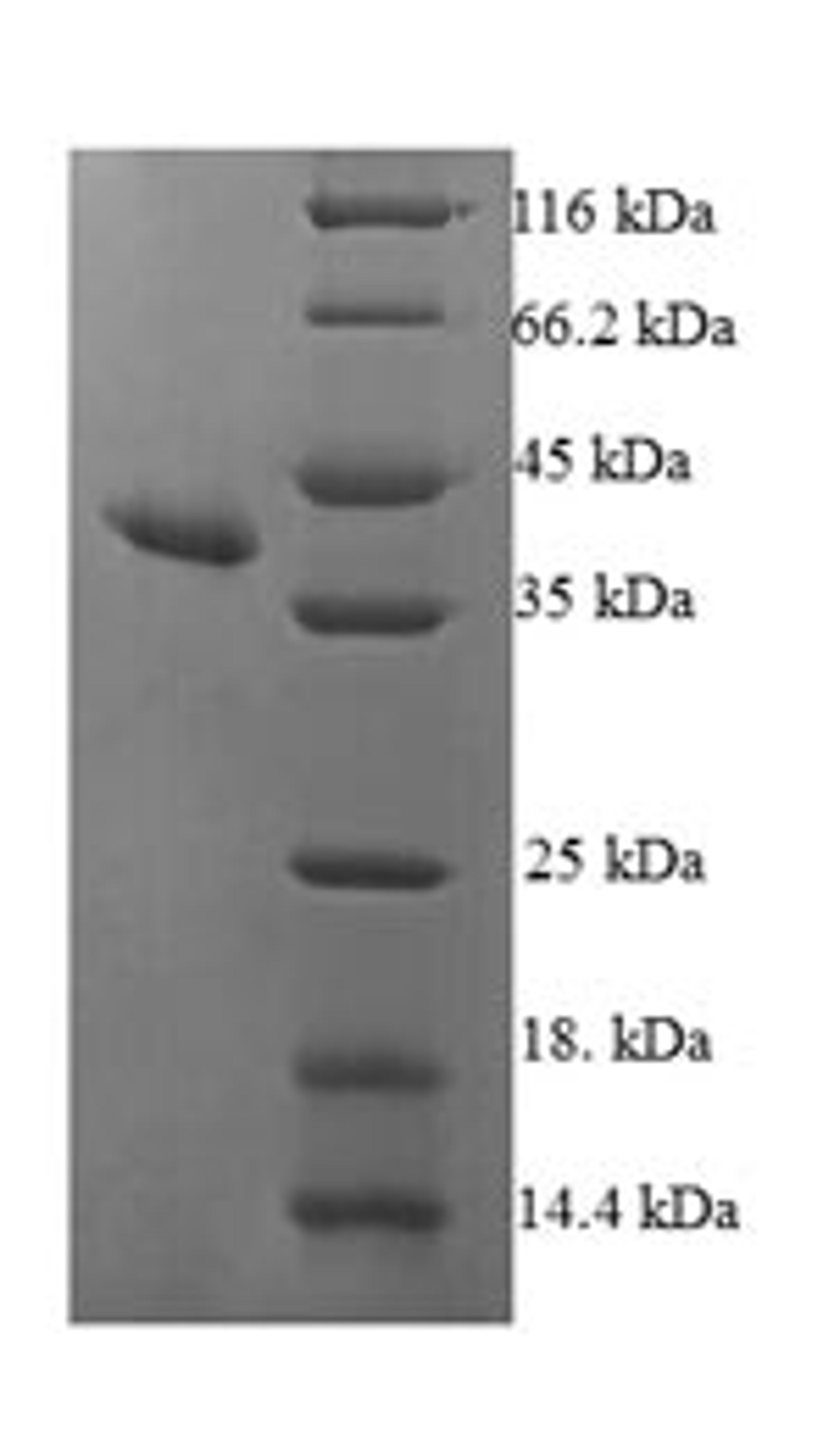 (Tris-Glycine gel) Discontinuous SDS-PAGE (reduced) with 5% enrichment gel and 15% separation gel.