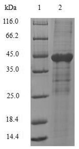 (Tris-Glycine gel) Discontinuous SDS-PAGE (reduced) with 5% enrichment gel and 15% separation gel.