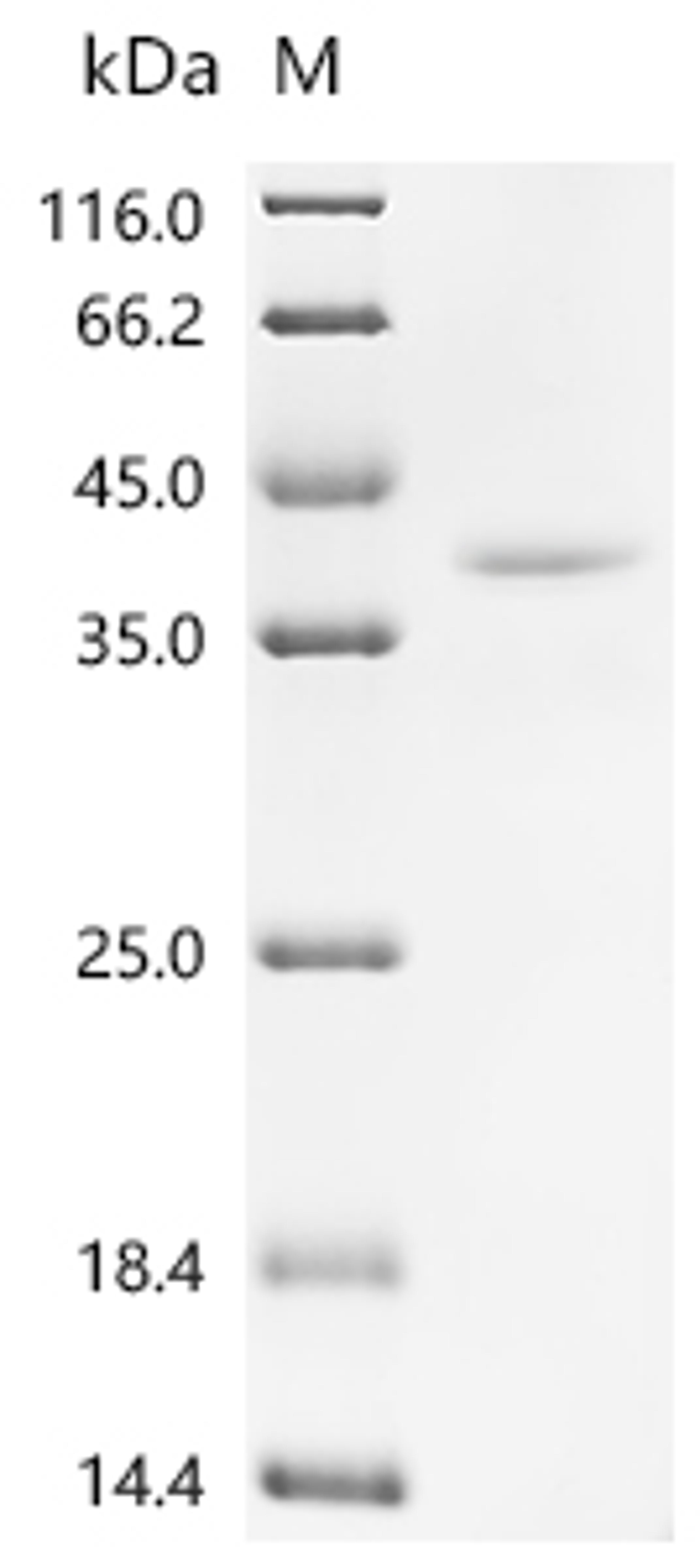 (Tris-Glycine gel) Discontinuous SDS-PAGE (reduced) with 5% enrichment gel and 15% separation gel.