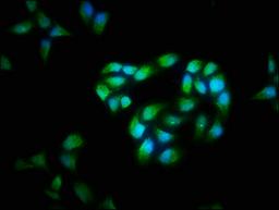 Immunofluorescence staining of Hela cells with CSB-PA005282LA01HU at 1:40, counter-stained with DAPI. The cells were fixed in 4% formaldehyde, permeabilized using 0.2% Triton X-100 and blocked in 10% normal Goat Serum. The cells were then incubated with the antibody overnight at 4&deg;C. The secondary antibody was Alexa Fluor 488-congugated AffiniPure Goat Anti-Rabbit IgG(H+L).