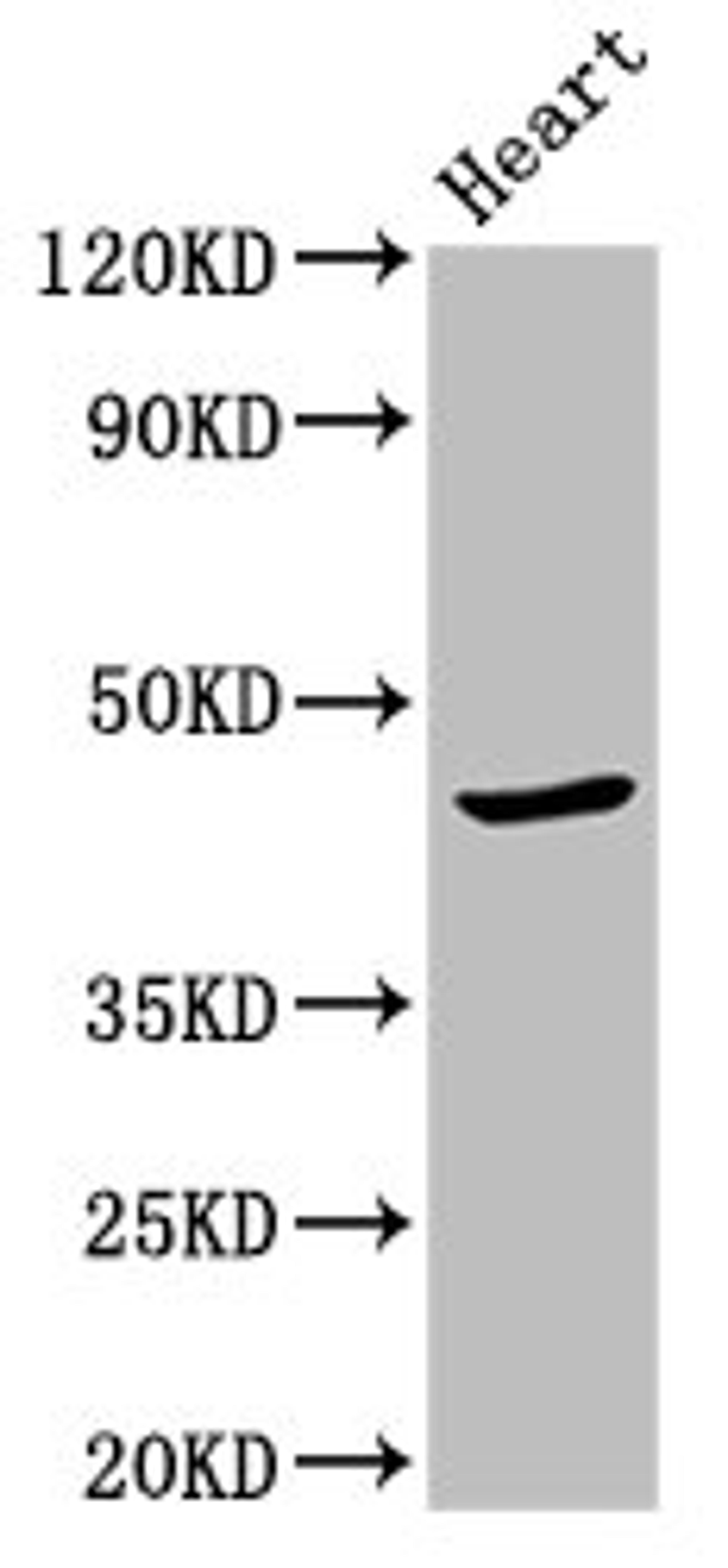 Western Blot. Positive WB detected in: Mouse heart tissue. All lanes: APOBEC3F antibody at 2.7ug/ml. Secondary. Goat polyclonal to rabbit IgG at 1/50000 dilution. Predicted band size: 46, 10, 12 kDa. Observed band size: 46 kDa. 