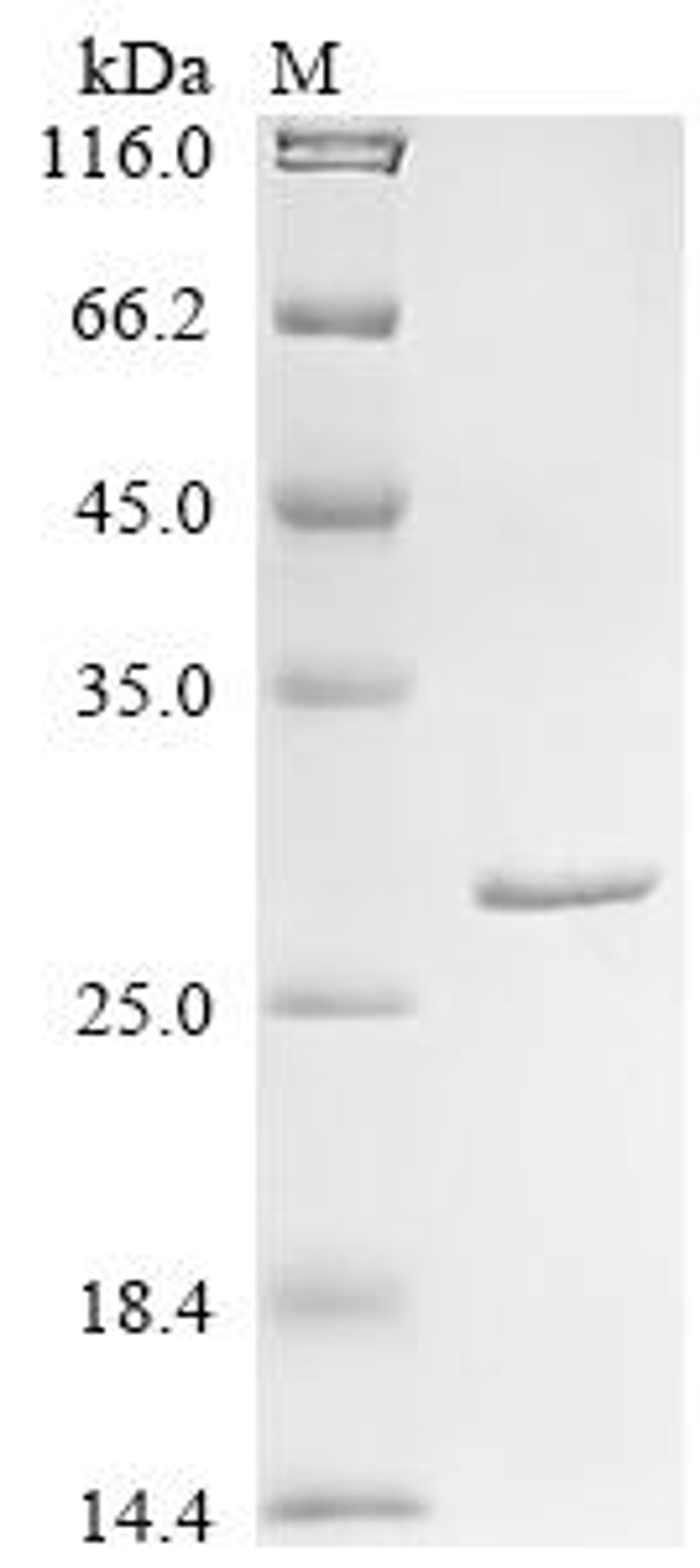 (Tris-Glycine gel) Discontinuous SDS-PAGE (reduced) with 5% enrichment gel and 15% separation gel.
