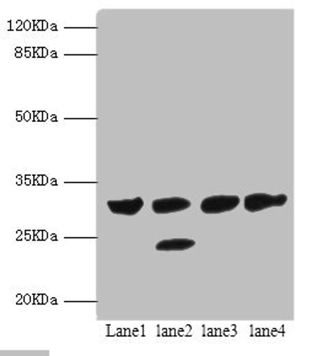 Western blot. All lanes: PSME1 antibody at 1.4ug/ml. Lane 1: Mouse liver tissue. Lane 2: Mouse thymus tissue. Lane 3: Raji whole cell lysate. Lane 4: HL60 whole cell lysate. Secondary. Goat polyclonal to rabbit IgG at 1/10000 dilution. Predicted band size: 29, 27 kDa. Observed band size: 29, 25 kDa. 