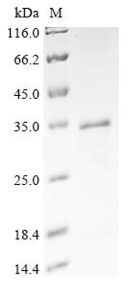 (Tris-Glycine gel) Discontinuous SDS-PAGE (reduced) with 5% enrichment gel and 15% separation gel.