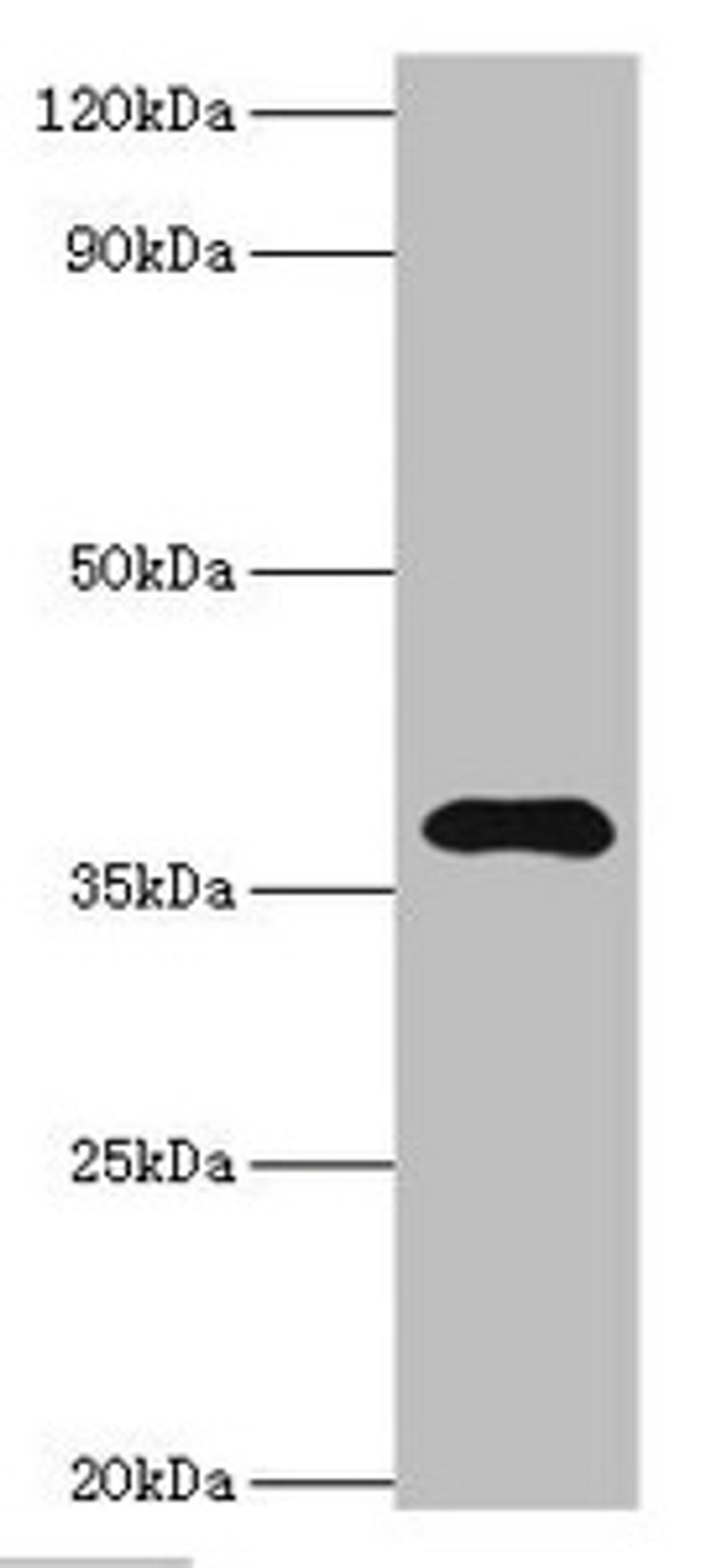 Western blot. All lanes: Leucine-rich alpha-2-glycoprotein antibody at 4ug/ml + HepG2 whole cell lysate. Secondary. Goat polyclonal to rabbit IgG at 1/10000 dilution. Predicted band size: 38 kDa. Observed band size: 38 kDa. 