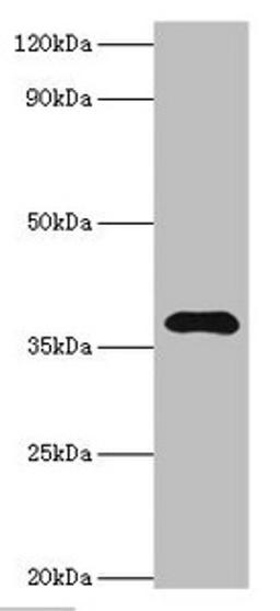 Western blot. All lanes: Leucine-rich alpha-2-glycoprotein antibody at 4ug/ml + HepG2 whole cell lysate. Secondary. Goat polyclonal to rabbit IgG at 1/10000 dilution. Predicted band size: 38 kDa. Observed band size: 38 kDa. 