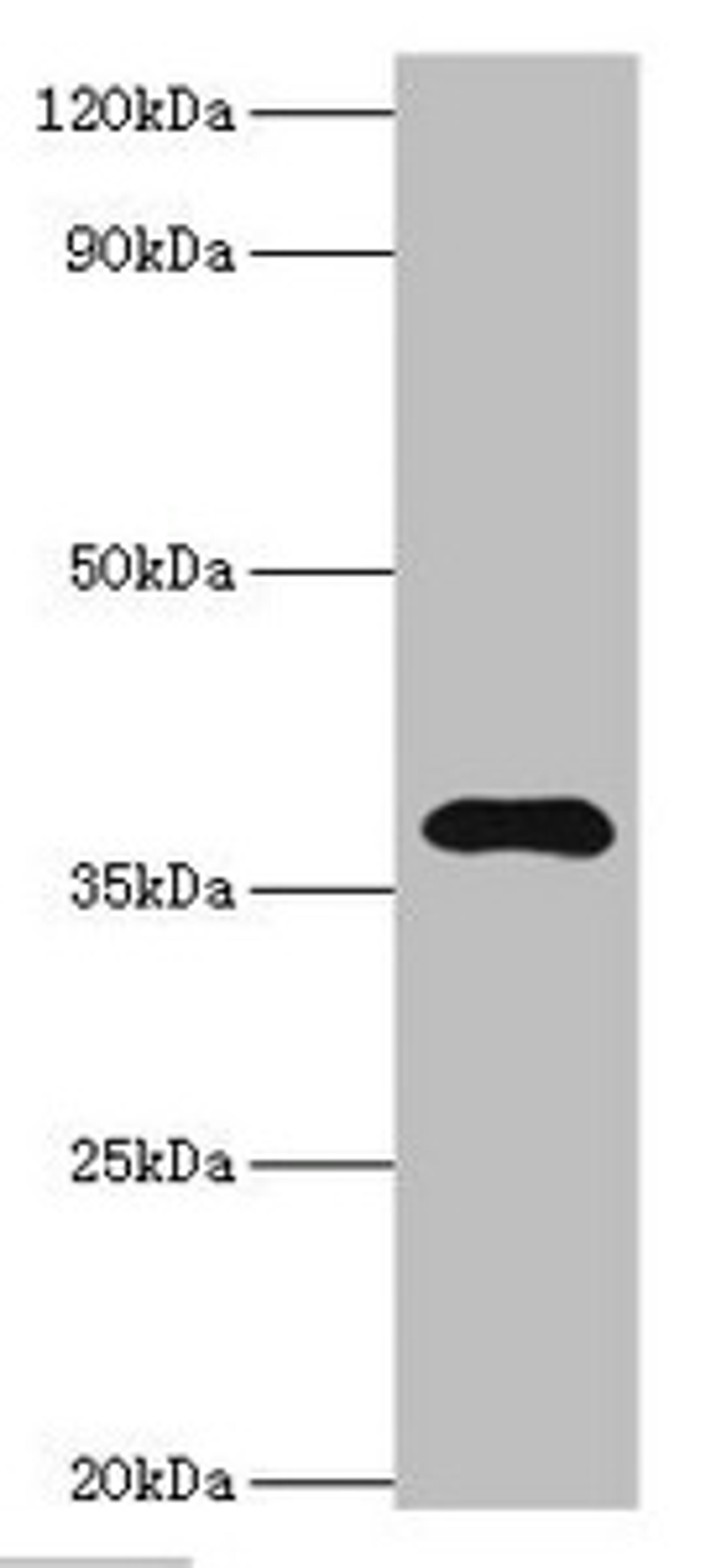 Western blot. All lanes: Leucine-rich alpha-2-glycoprotein antibody at 4ug/ml + HepG2 whole cell lysate. Secondary. Goat polyclonal to rabbit IgG at 1/10000 dilution. Predicted band size: 38 kDa. Observed band size: 38 kDa. 