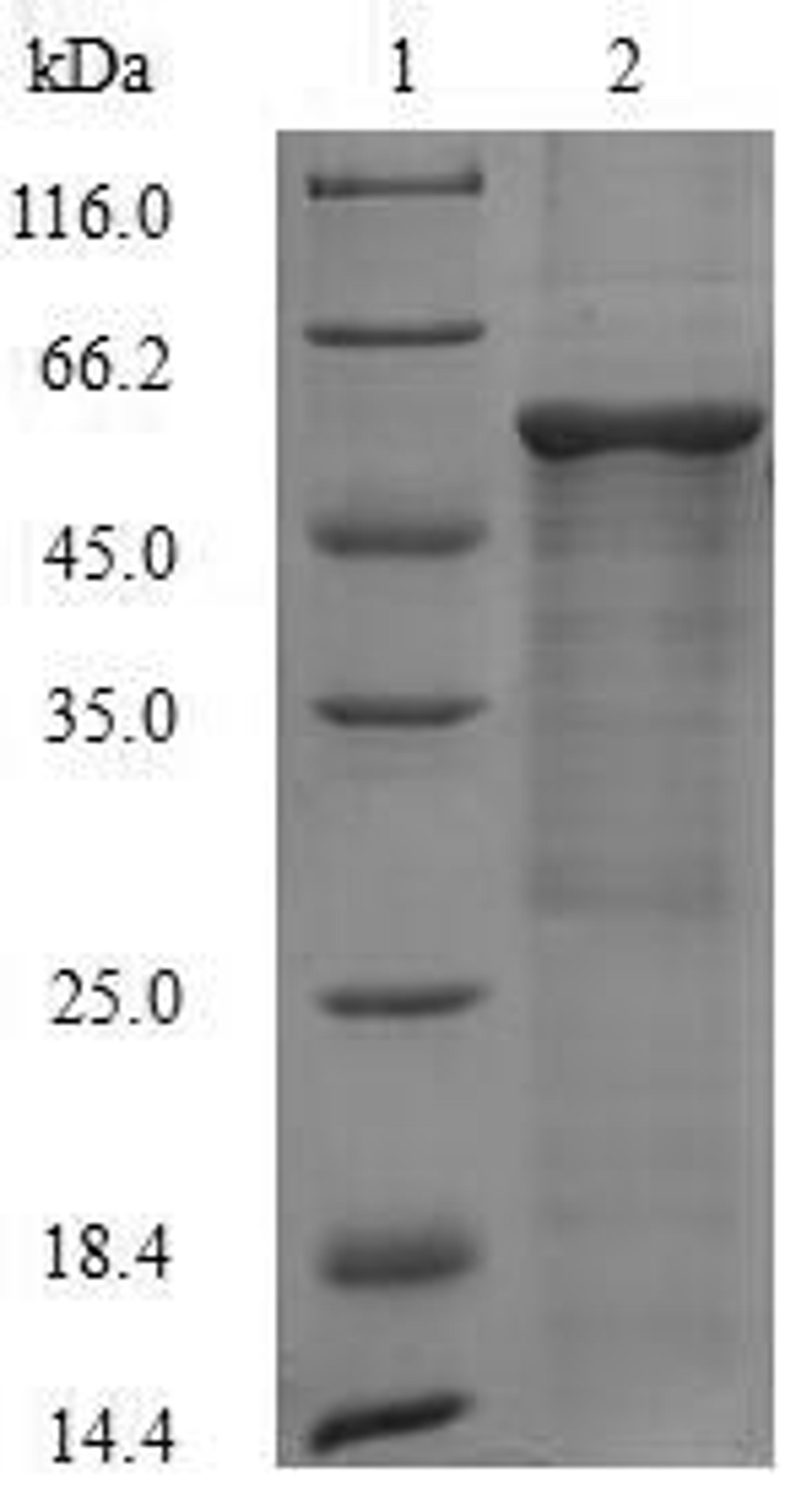 (Tris-Glycine gel) Discontinuous SDS-PAGE (reduced) with 5% enrichment gel and 15% separation gel.