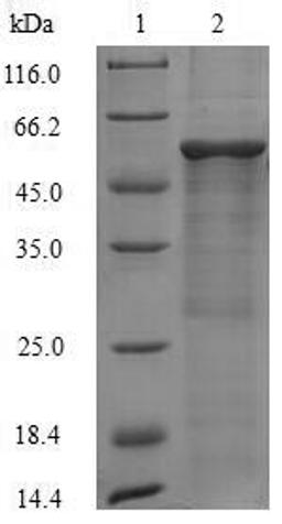 (Tris-Glycine gel) Discontinuous SDS-PAGE (reduced) with 5% enrichment gel and 15% separation gel.