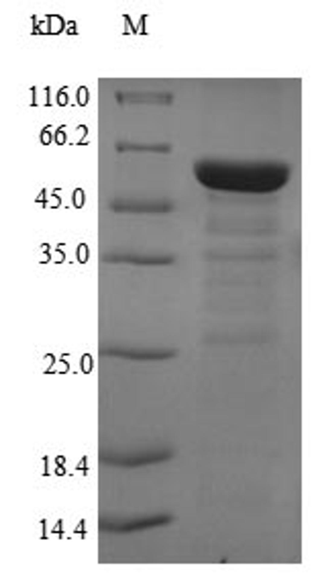 (Tris-Glycine gel) Discontinuous SDS-PAGE (reduced) with 5% enrichment gel and 15% separation gel.