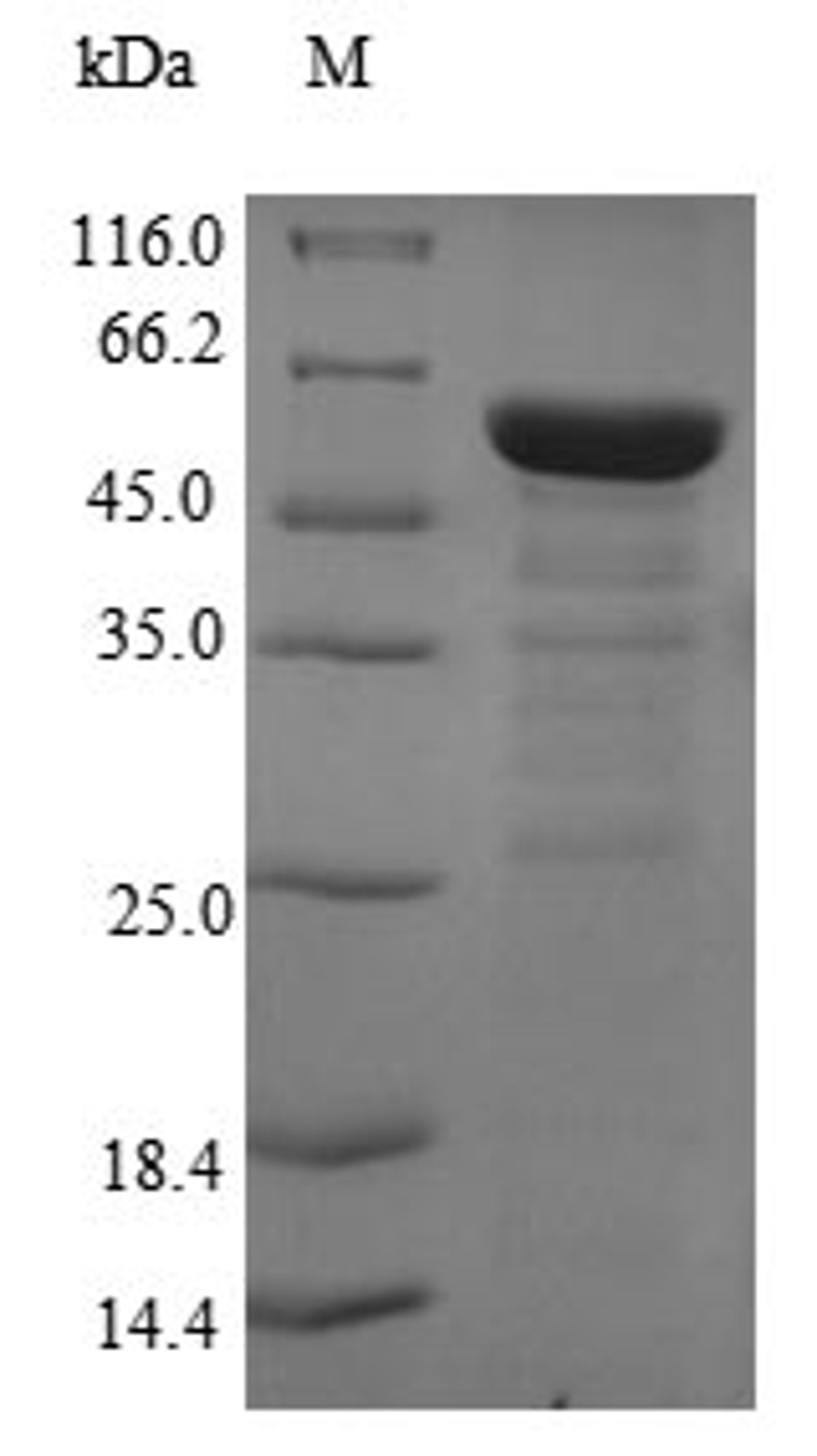 (Tris-Glycine gel) Discontinuous SDS-PAGE (reduced) with 5% enrichment gel and 15% separation gel.