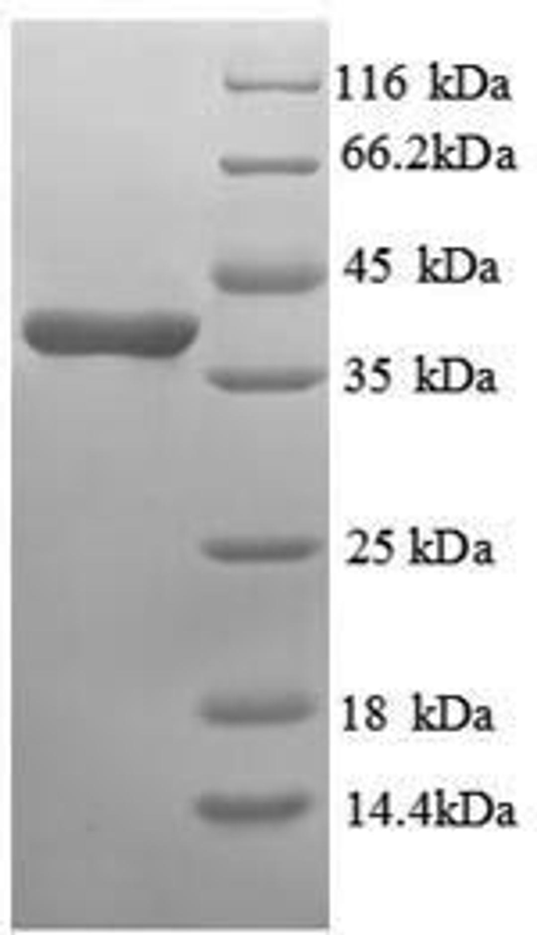 (Tris-Glycine gel) Discontinuous SDS-PAGE (reduced) with 5% enrichment gel and 15% separation gel.