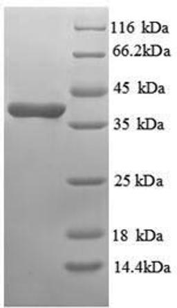 (Tris-Glycine gel) Discontinuous SDS-PAGE (reduced) with 5% enrichment gel and 15% separation gel.