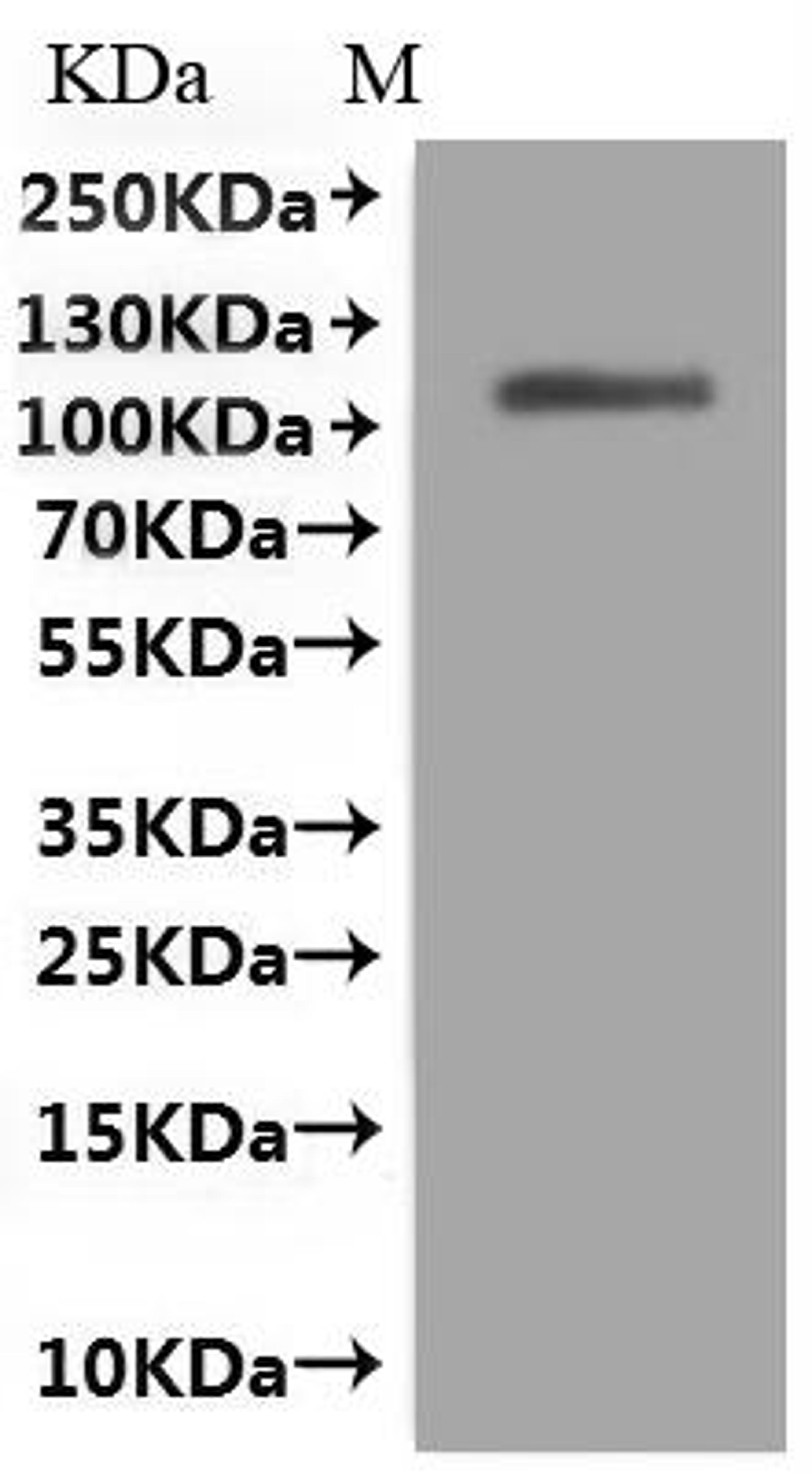 (Tris-Glycine gel) Discontinuous SDS-PAGE (reduced) with 5% enrichment gel and 15% separation gel.