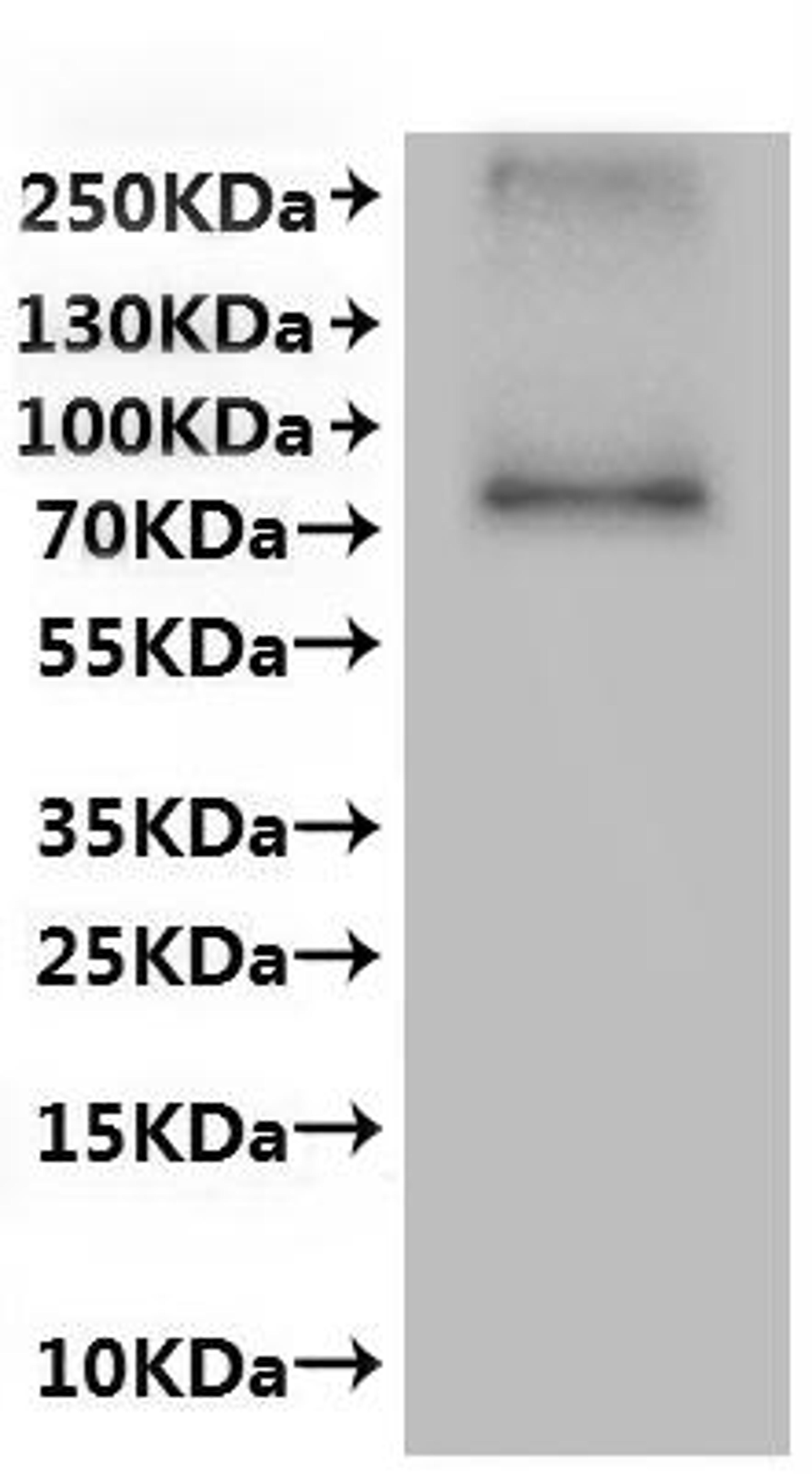 CSB-MP861992HU is detected by Mouse anti-6*His monoclonal antibody.