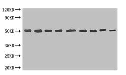 MBP-tagged fusion protein(20ng/ml) was subjected to SDS-PAGE followed by Western Blot with CSB-MA000061M0m at dilution of . Lane 1:1000 Lane 4:8000 Lane 7:64000. Lane 2:2000 Lane 5:16000 Lane 8:128000. Lane 3:4000 Lane 6:32000 Lane 9:256000. Secondary. Goat polyclonal to Mouse IgG at 1/5000 dilution. Predicted band size:50kd. Observed band size:50kd. 