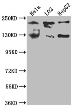 Western Blot. Positive WB detected in: Hela whole cell lysate, L02 whole cell lysate, HepG2 whole cell lysate. All lanes: MGEA5 antibody at 1:1000. Secondary. Goat polyclonal to rabbit IgG at 1/50000 dilution. Predicted band size: 103, 96, 77, 97 kDa. Observed band size: 130 kDa. 