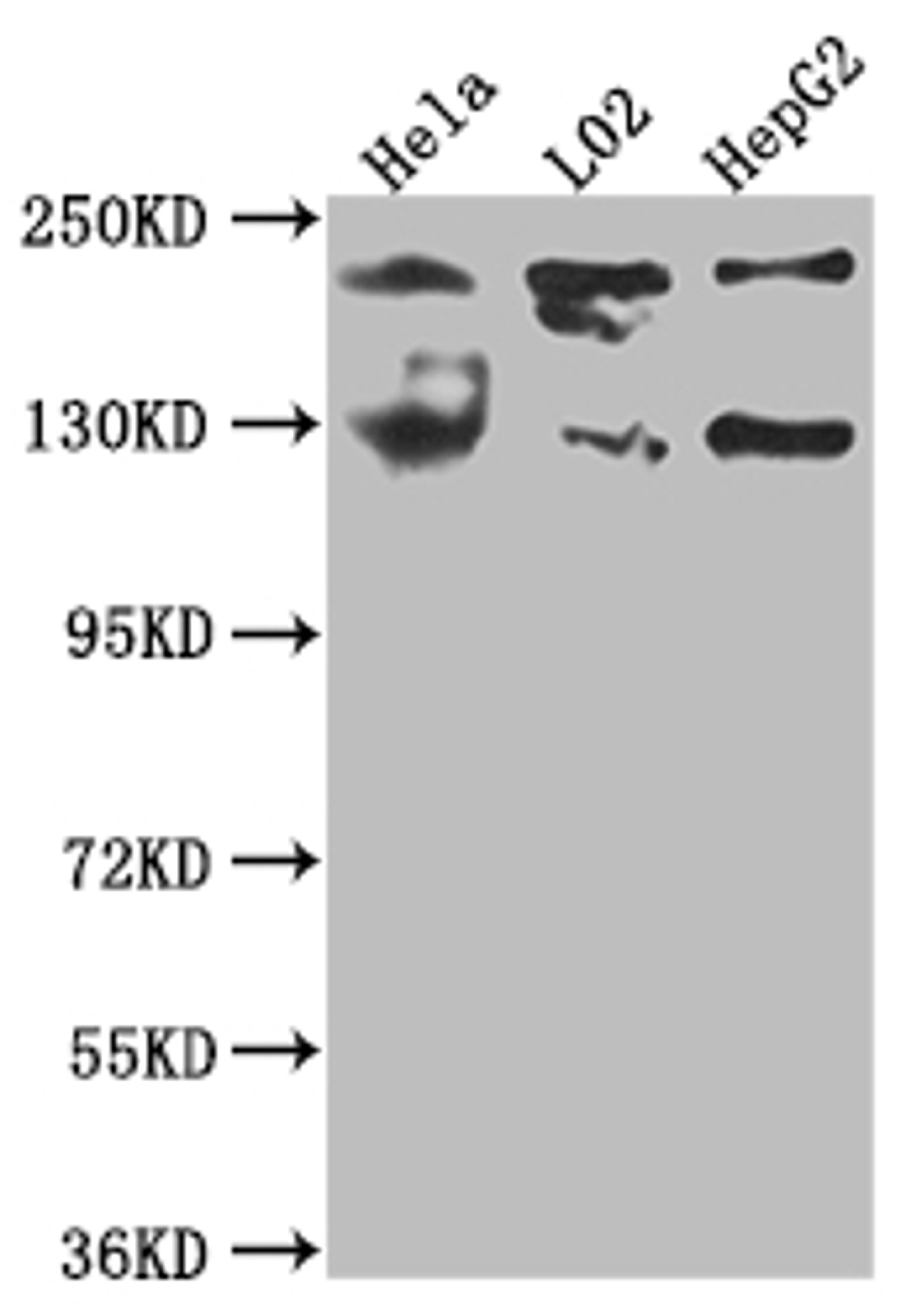 Western Blot. Positive WB detected in: Hela whole cell lysate, L02 whole cell lysate, HepG2 whole cell lysate. All lanes: MGEA5 antibody at 1:1000. Secondary. Goat polyclonal to rabbit IgG at 1/50000 dilution. Predicted band size: 103, 96, 77, 97 kDa. Observed band size: 130 kDa. 