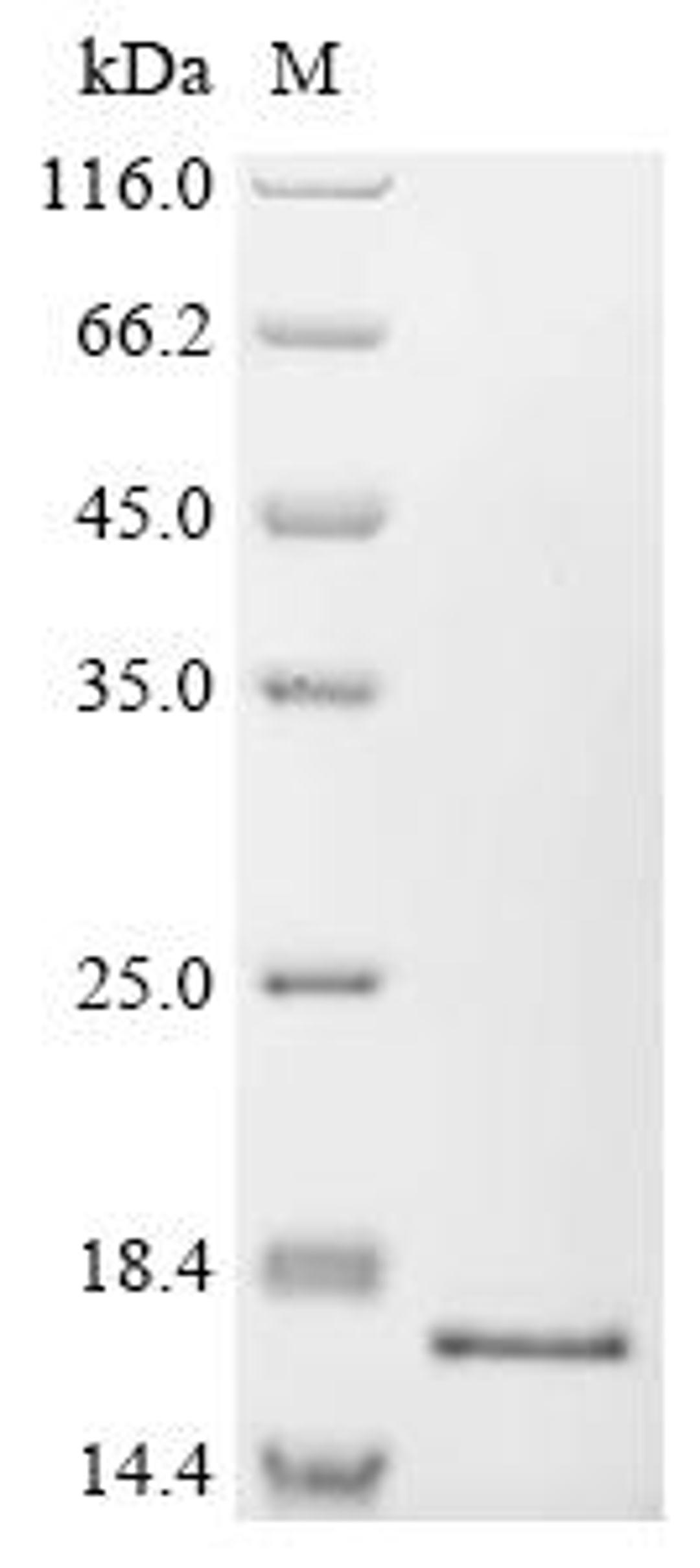 (Tris-Glycine gel) Discontinuous SDS-PAGE (reduced) with 5% enrichment gel and 15% separation gel.